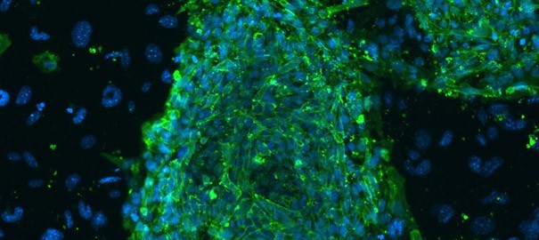 De l’épiderme recréé à partir de cellules souches